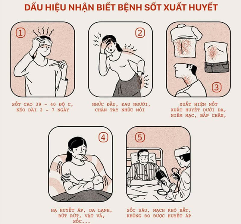 Dấu hiệu để nhận biết sốt xuất huyết