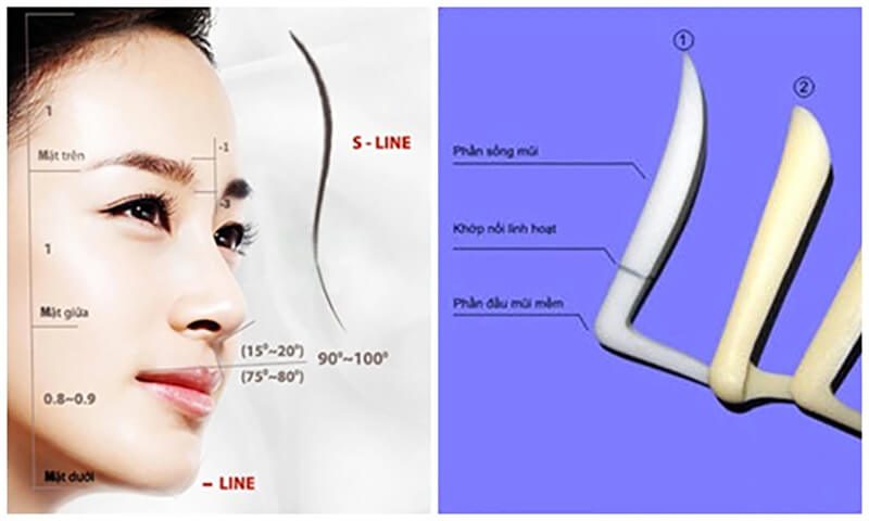 Ưu điểm vượt trội của phương pháp nâng mũi cấu trúc