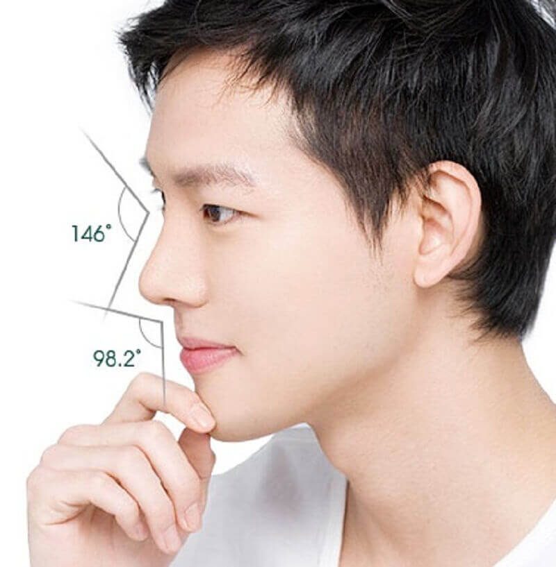 Nâng mũi L line phù hợp với nam giới