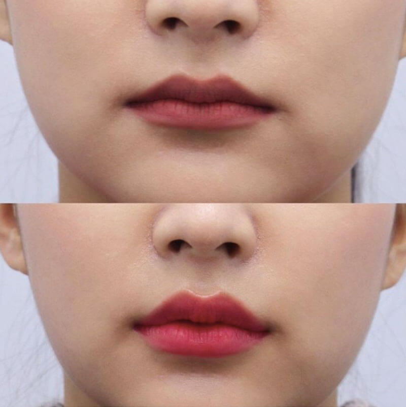 Có nên lựa chọn Thẩm mỹ viện lông Mày đẹp Kiwi?