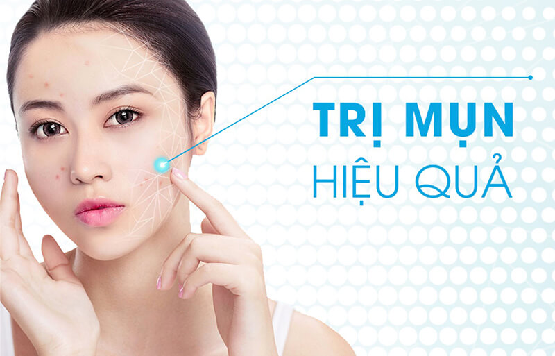 Xịt trị mụn Skin Fresh: Loại sạch mụn, da sáng tươi