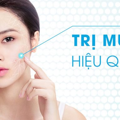 Xịt trị mụn Skin Fresh: Loại sạch mụn, da sáng tươi